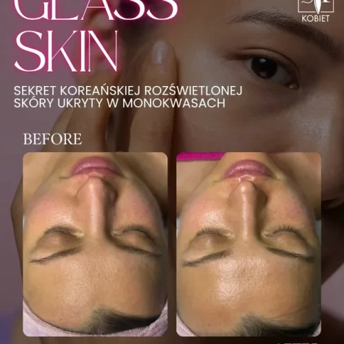 Glass skin