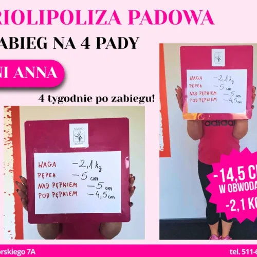 kriolipoliza-padowa-brzuch-1-zabieg-minus-14-5-cm-minus-2-1-kg-4-tygodnie